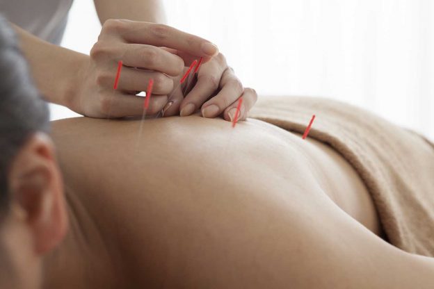 asweatlife_acupuncture-624x416.jpg