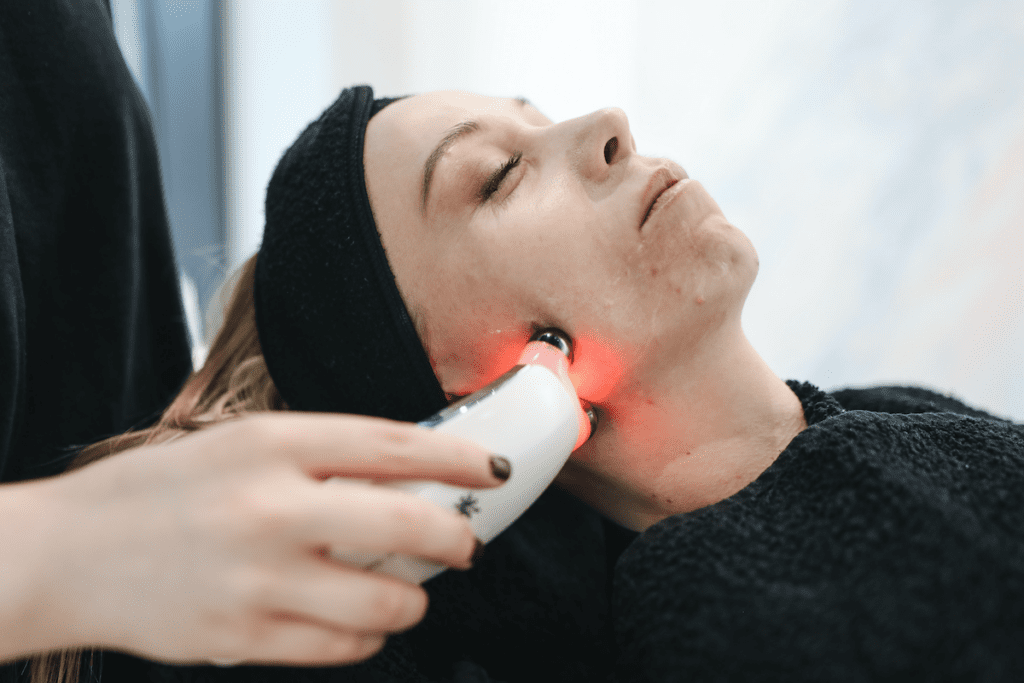 person having laser skin resurfacing treatment