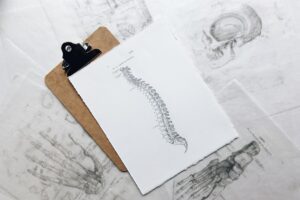 doctor chart with drawing of spine